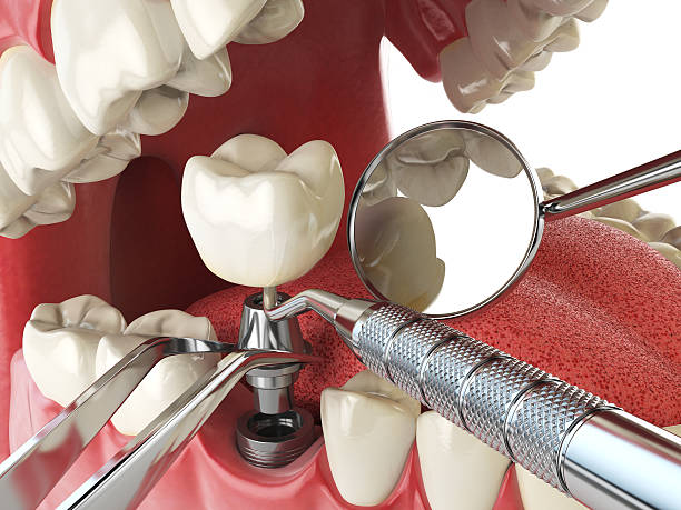 Best Cracked Tooth Emergency Dentist  in Mansfield, TX